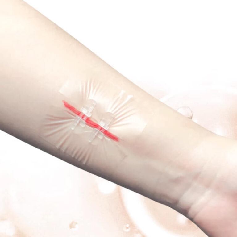 Silicon gel suture free adhesive tape (1)
