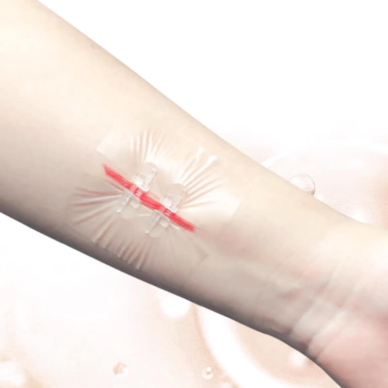 Silicon gel suture free adhesive tape (1)