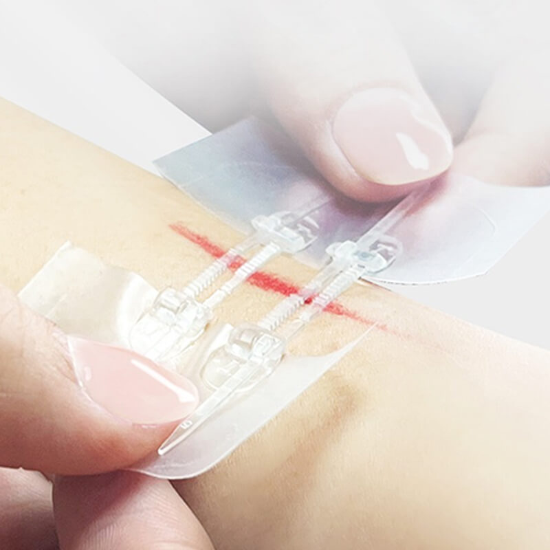 Silicon gel suture free adhesive tape (2)