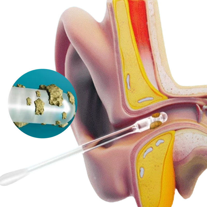 Silicone-surface-rod -3